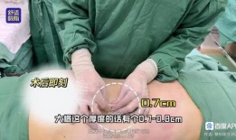 爆料桂哥抽脂视频教程大全,揭秘脂肪管理新潮流